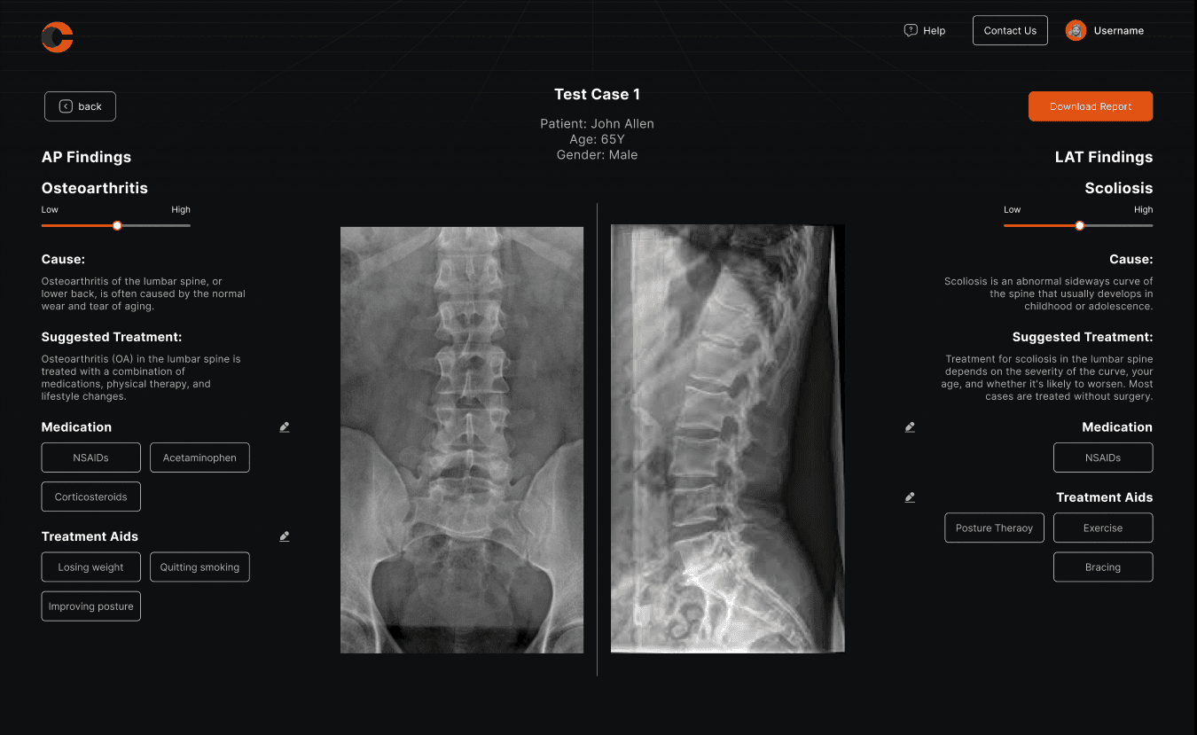 Spine Surgical Planning