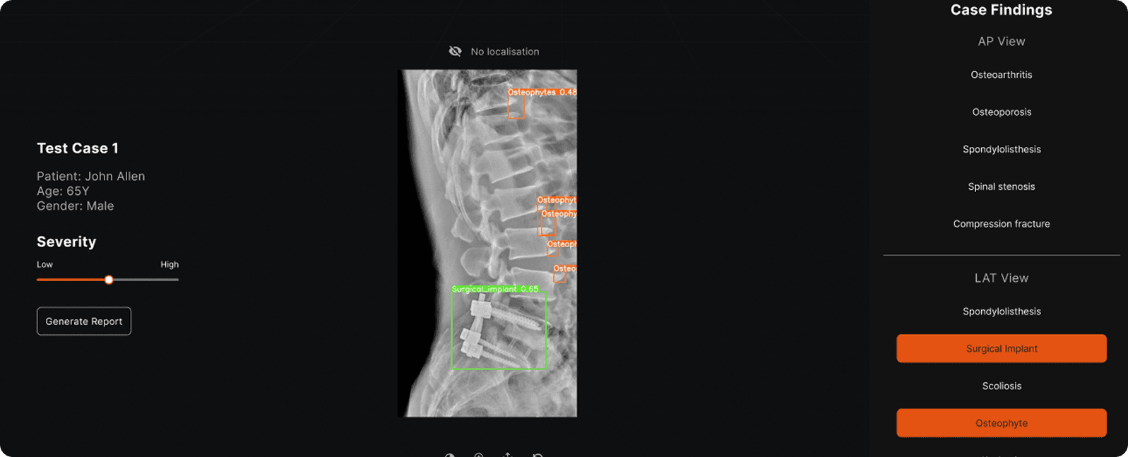Spine Research Platform