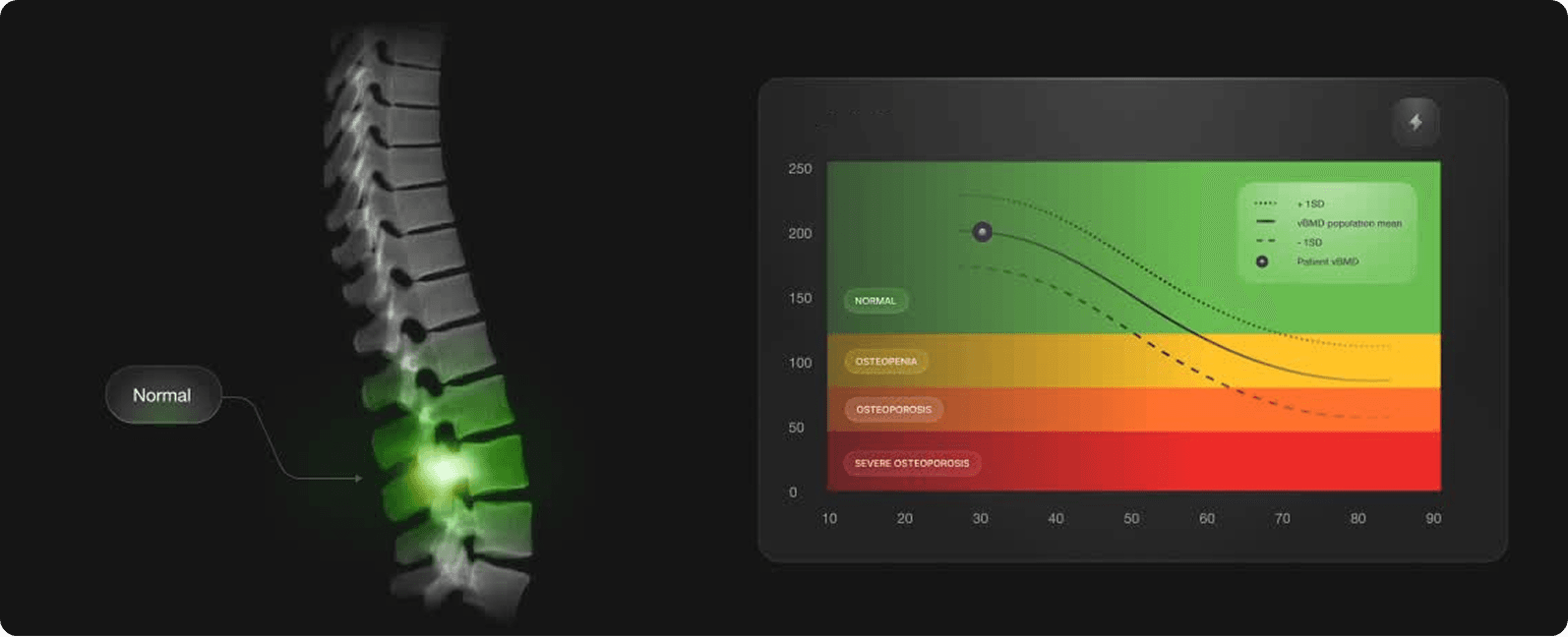 Spine Analysis Graph